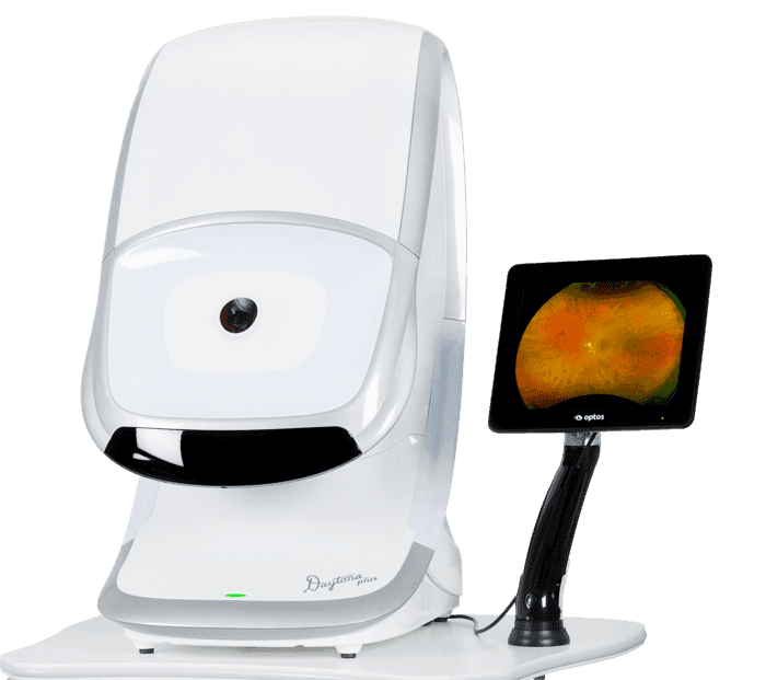 optos retinal image scanning machine